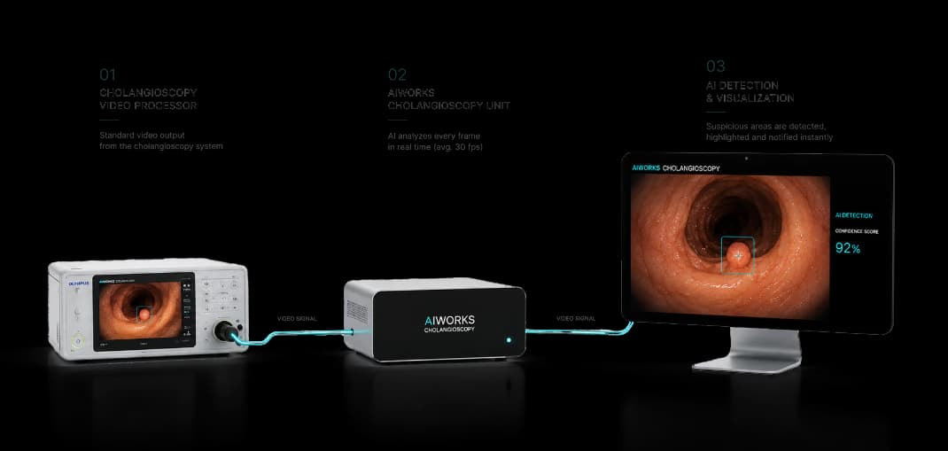 Endoscopic video source connected to aiworks equipment and an analysis monitor