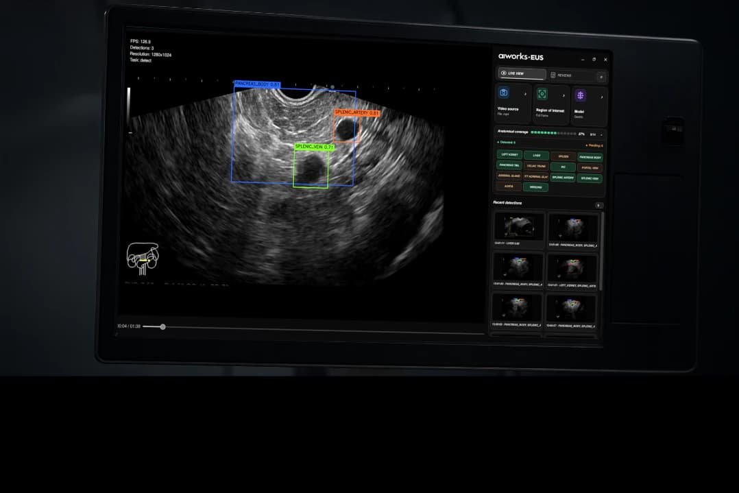 aiworks E.U.S. monitor identifying anatomical structures in endoscopic ultrasound
